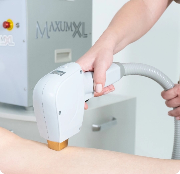 aparato laser e ipl-shr de ultima generación- clinica estética-trabajo sobre piel-luxora