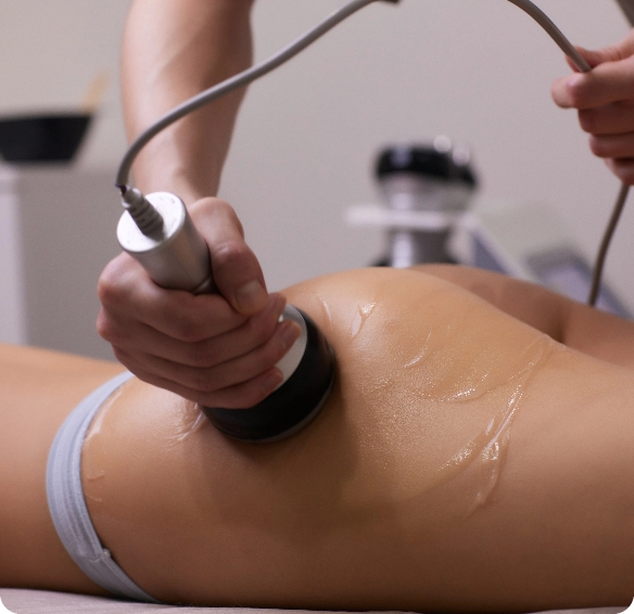 correccion-de-figura-de-hardware-cosmetologia-de-la-maquina-hermosa-mujer-con-cavitacion-procedimiento-para-eliminar-la-celulitis-en-las-nalgas-láser-